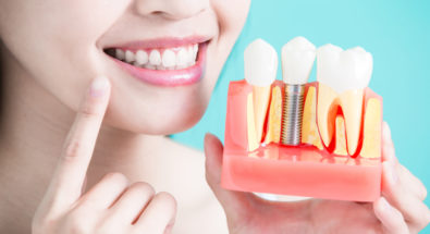 Woman smiling holding up dental implant demonstration